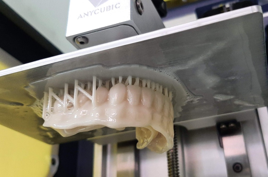 Impresión 3D dental